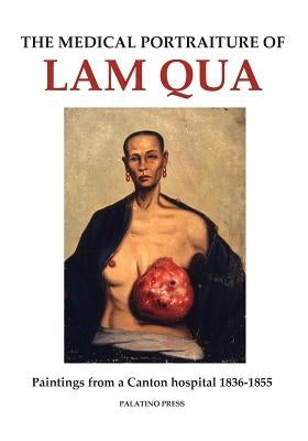 The Medical Portraiture of Lam Qua: Paintings from a Canton hospital 1836-1855 Paperback Createspace Independent Publishing Platform
