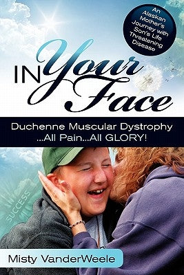In Your Face Duchenne Muscular Dystrophy All Pain All Glory Paperback Misty Vanderweele