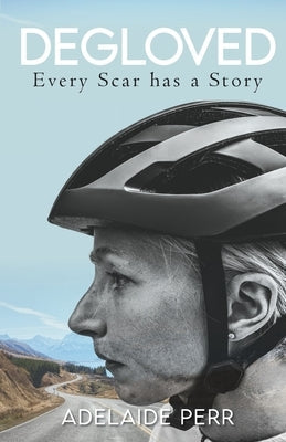 Degloved: Every Scar has a Story Paperback Cherish Editions